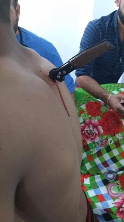 صور سيدة داعشية تطعن حارسها بـ سكين فى ظهره بمخيم الهول اليوم السابع
