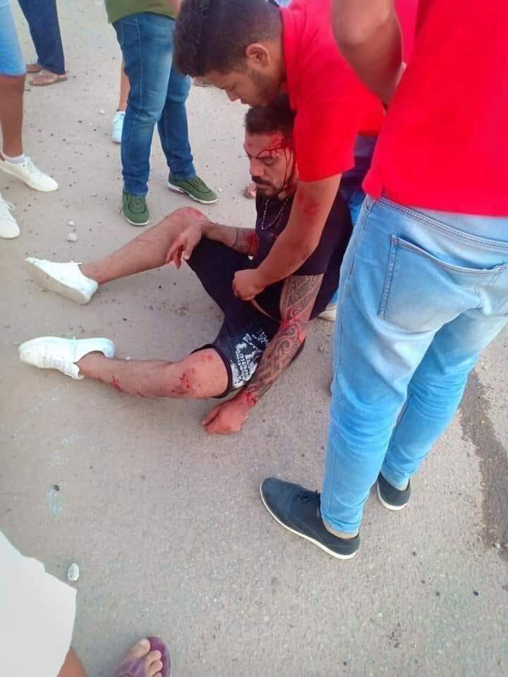 إصابة عمرو زكي نجم الكرة السابق في حادث سيارة بالساحل الشمالي (4)