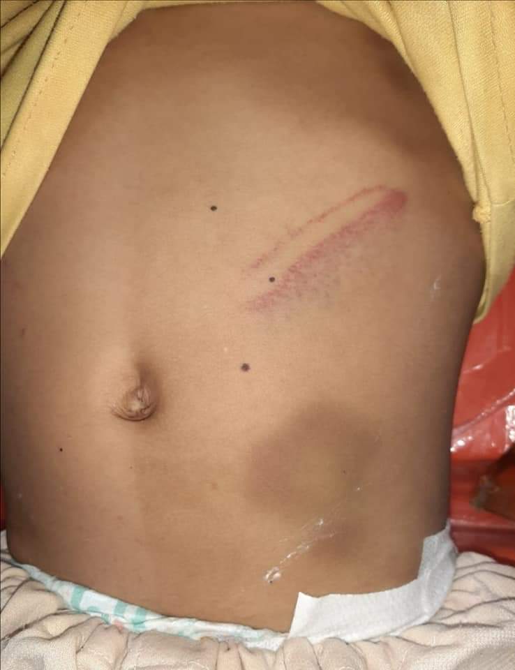 تعذيب الطفلة على يد زوجه أبيها بالقليوبية (2)
