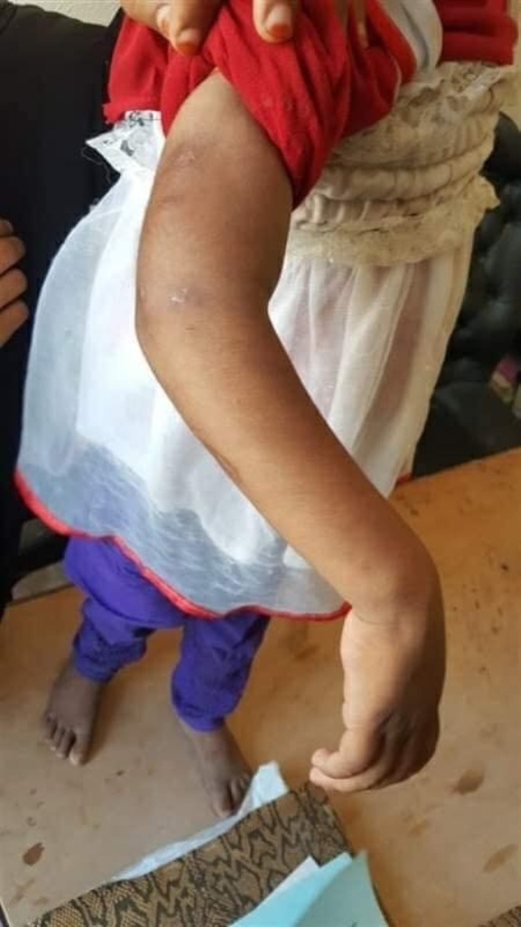 أب بعذيب أطفاله الـ 3 انتقاماُ من طليقته السابقة بمدينة العلمين (1)