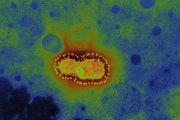 فيروس كورونا الجديد تحت المجهر