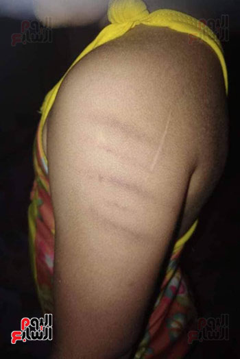 تعذيب فتاة بدار أيتام فى العاشر من رمضان (3)
