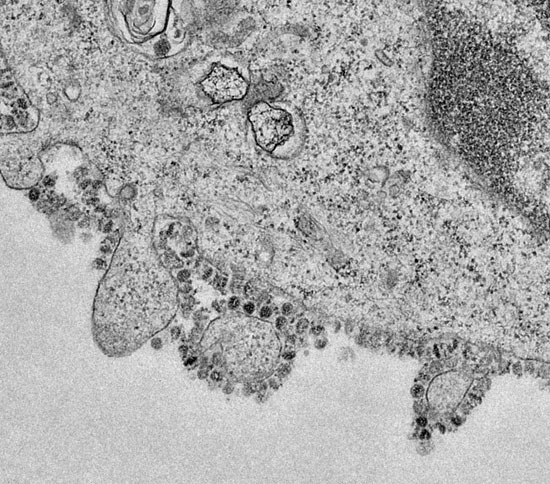 اول صورة مجهرية لفيروس كورونا