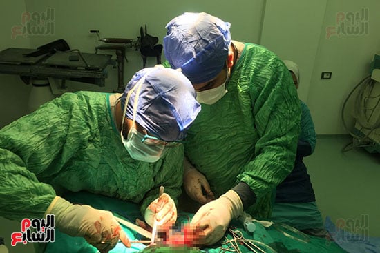 نجاح أول جراحة لكسر بعظام الجمجمة بمستشفى فاقوس (2)