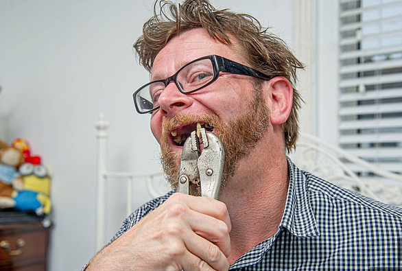 عامل بريطاني يخلع أسنانه بالكماشة لعدم قدرته الذهاب لطبيب بسبب كورونا..  (1)