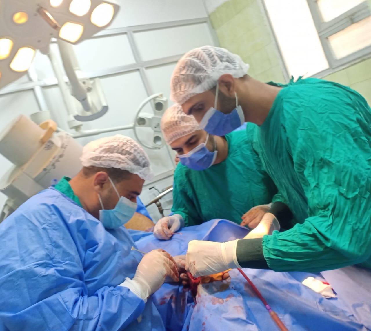 الأطباء خلال إجراء العملية الجراحية  (1)