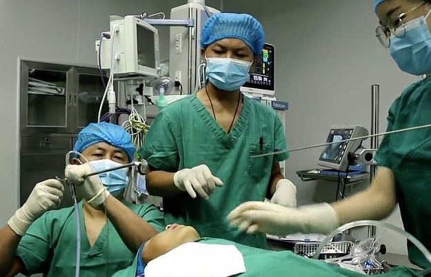 طفل يجرى عملية جراحية لإزالة دودة حية سبب مشاكل في التنفس (1)
