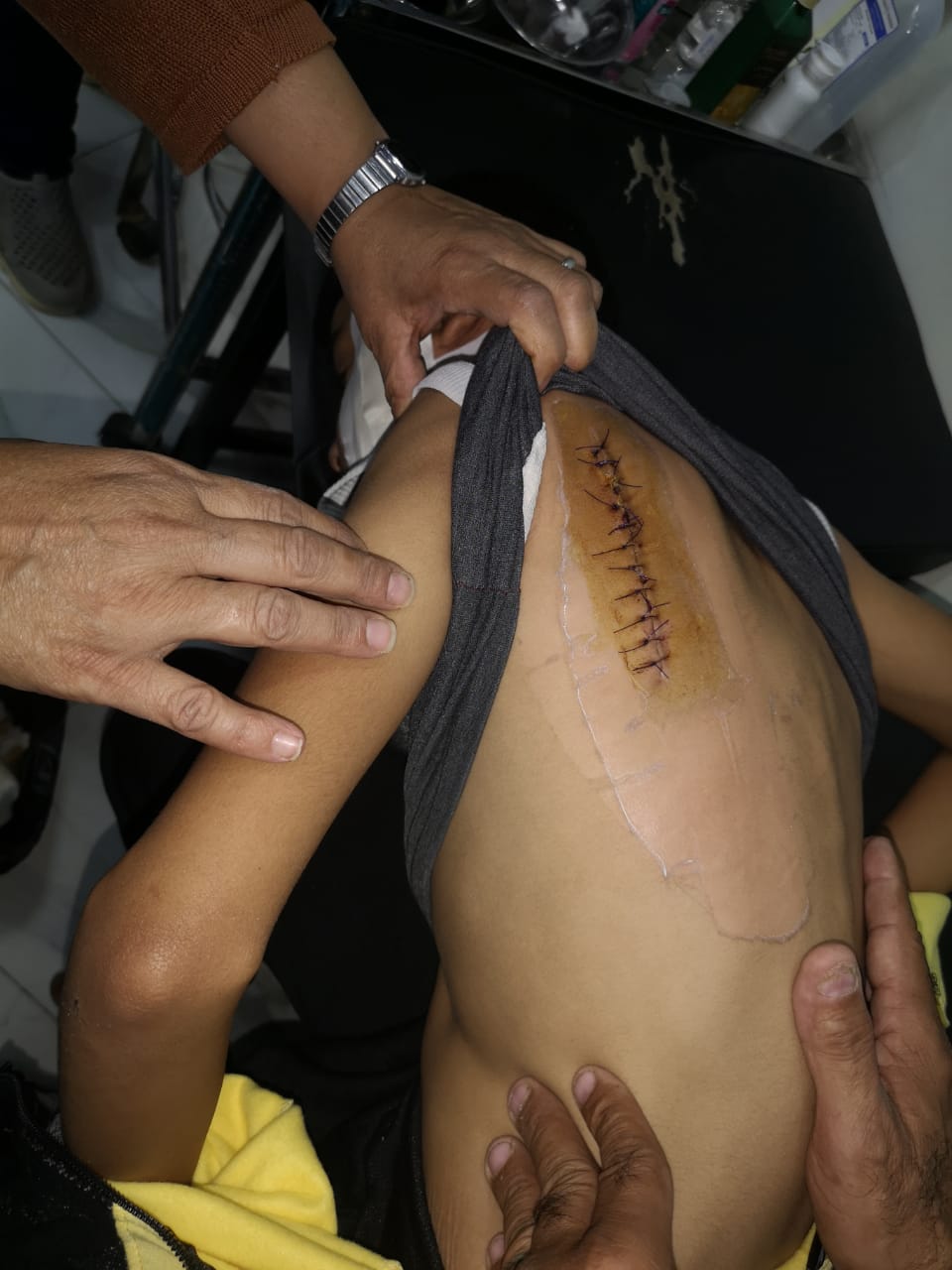 طالب يصاب بـ36 غرزة فى الشرقية