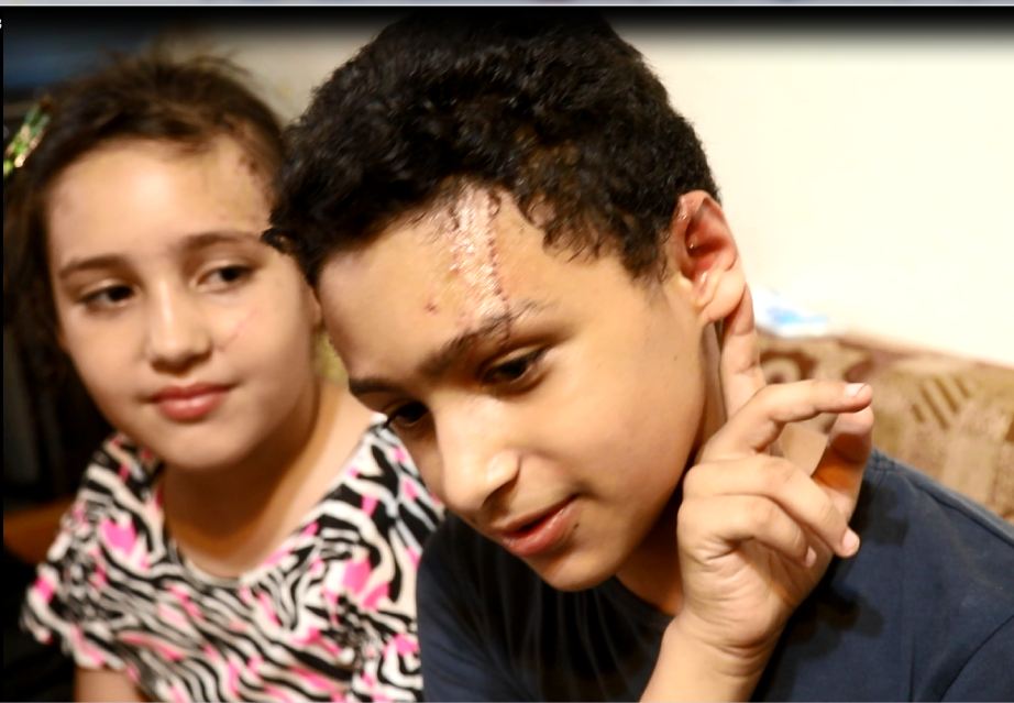 الطفل مصطفى نعمان أحد المصابين فى الانفجار