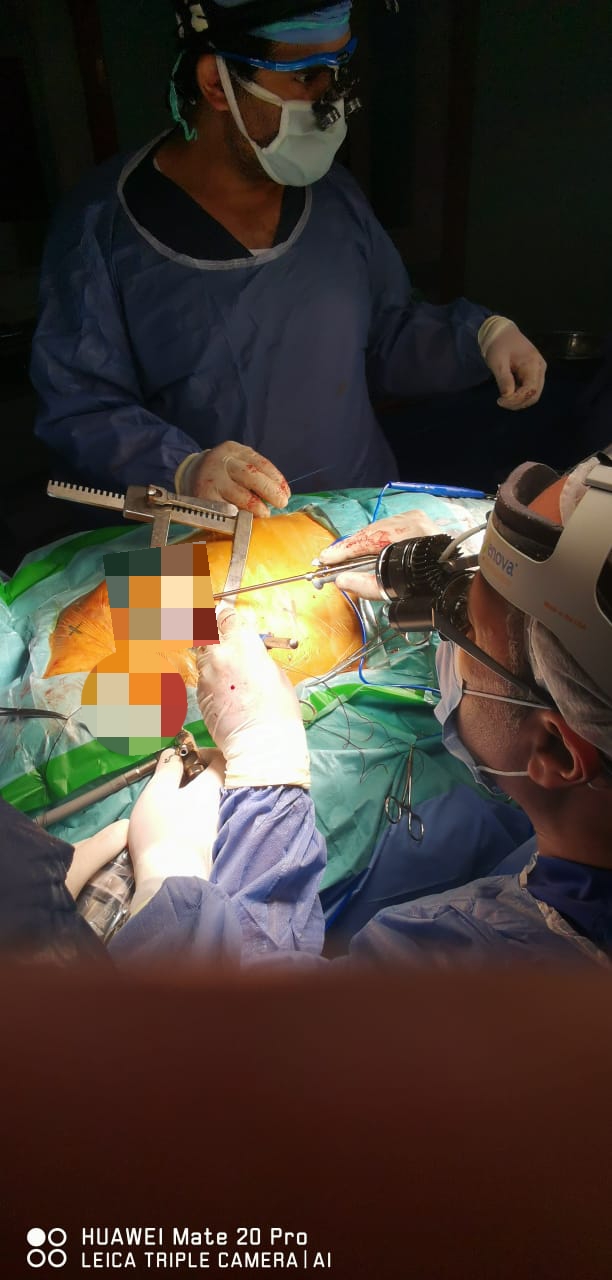 إجراء عملية جراحة قلب بالمنظار لتغيير الصمامات (4)