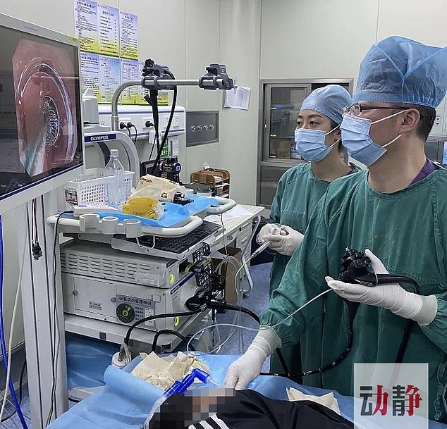 الأطباء يجرون الجراحة لأخراج حبات المغناطيس