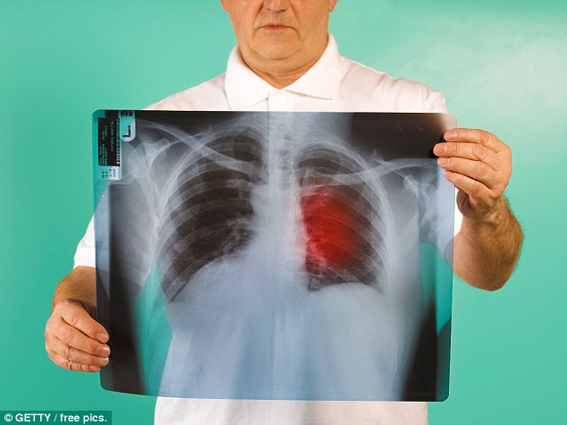 346D659A00000578-3611904-Thousands_of_people_with_lung_disease_are_suffering_systemic_neg-a-9_1464330768302