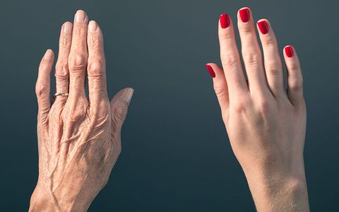 ageing-hands