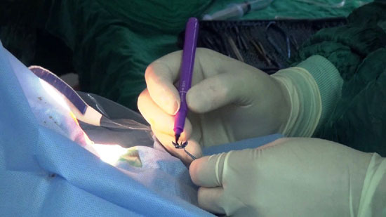 إجراء-10-عمليات-جراحية-لـزراعة-القرنية-بمستشفيات-جامعة-المنيا-(6)