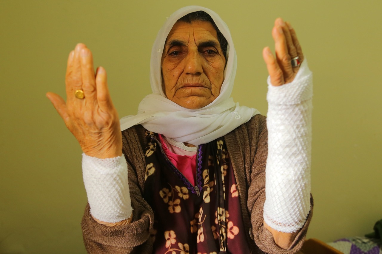 صور شرطة أردوغان تعتدى على عجوز عمرها 90 عاما وتصيبها فى ذراعها اليوم السابع