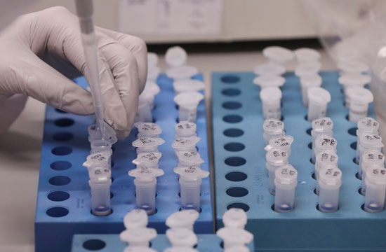 علماء يجرون أحاث للتوصل للقاح لفيروس كورونا