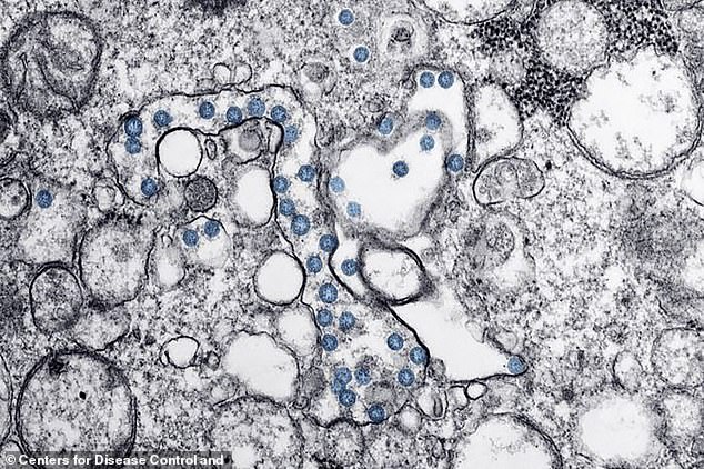 صورة مجهرية لمهاجمة فيروس كورونا على شكل نقاط زرقاء