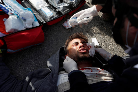 إصابة-فلسطينى