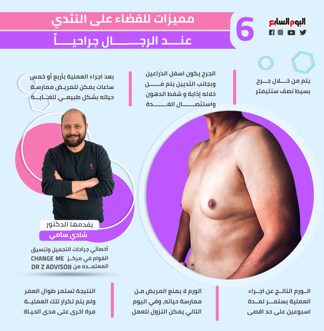 مميزات للقضاء على التثدي عند الرجال جراحياً