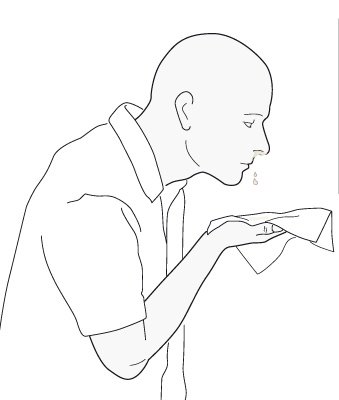 تسرب السائل الدماغي تسرب السائل الدماغي