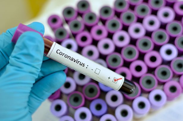 0_Coronavirus-positive
