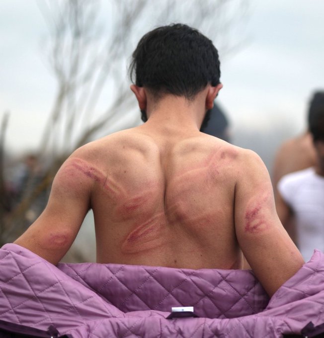جلد اللاجئين فى اليونان