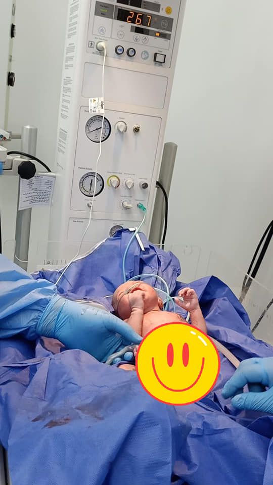 إجراء خامس عملية ولادة قيصرية لمصابة بكورونا بمستشفى إسنا للعزل