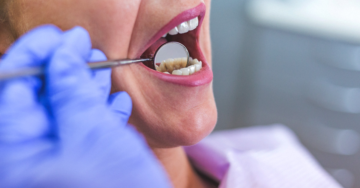 اعراض خراج الاسنان 12