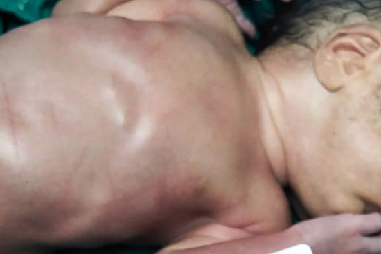 أحمد ومحمد.. أول مولودين لسيدتين مصابتين بكورونا بمستشفى جامعة الزقازيق (5)