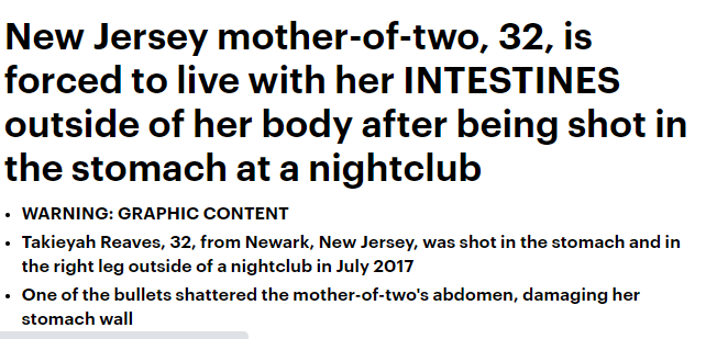 اخراج الامعاء خارج البطن فى حالة نادرة