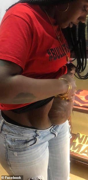 الامعاء خارج بطن السيدة الامعاء خارج بطن السيدة