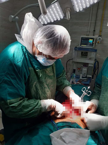 71470-إجراء-عملية-جراحية-لإصلاح-ثقب-بالأمعاء-لحالة-مصابة-بكورونا--(3)