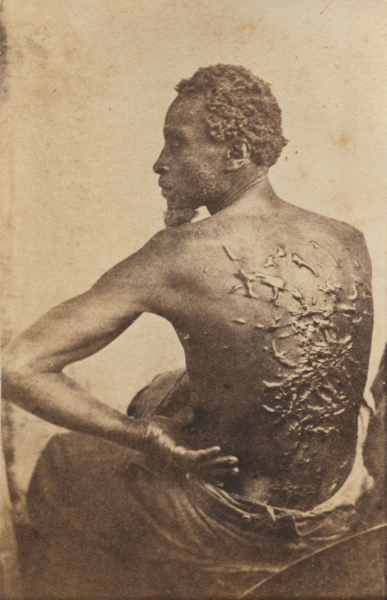 جوردون--هرب-من-العبودية-يظهر-ندبات-على-ظهره