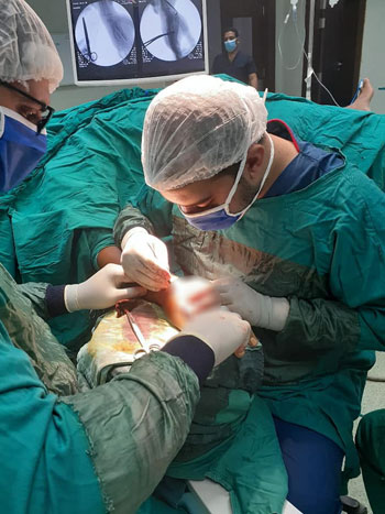 مستشفى أرمنت التخصصى تنقذ مواطن عقب إصابته بكسور في يده (1)
