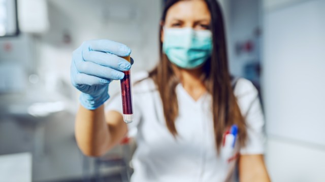 woman-lab-assitant-nurse-doctor-blood-probe-type