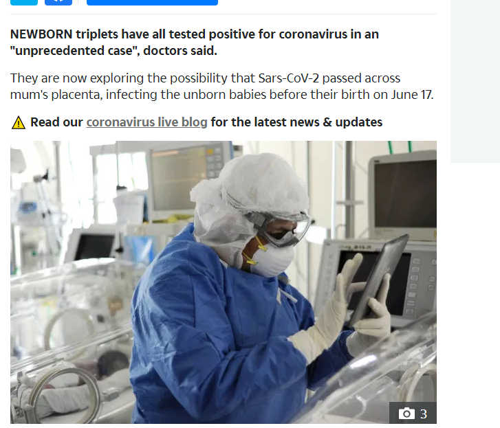 سبب اصابة 3 توائم بفيروس كورونا