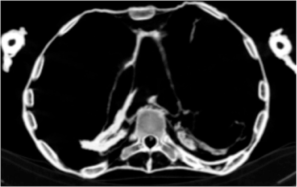 خلال إجراء الأشعة المقطعية على المومياء  (3)