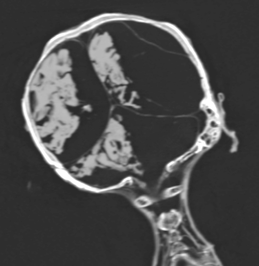 خلال إجراء الأشعة المقطعية على المومياء  (1)