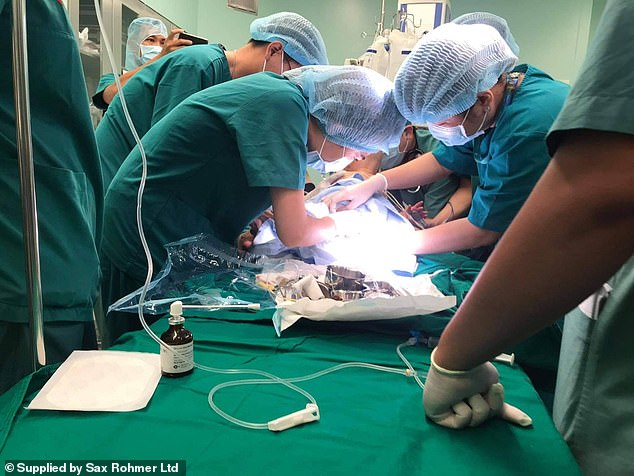 100 طبيب يفصلون توأما ملتصقا في عملية شاقة استغرقت 12 ساعة