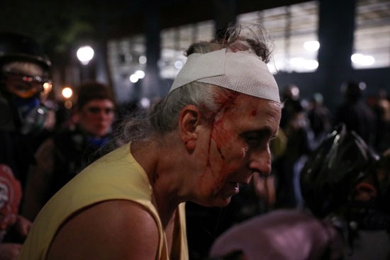 امرأة تتلقى الرعاية الطبية بعد إصابتها في الاحتجاجات