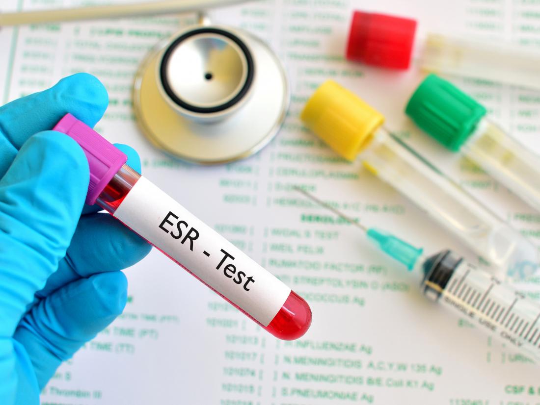 esr-blood-test