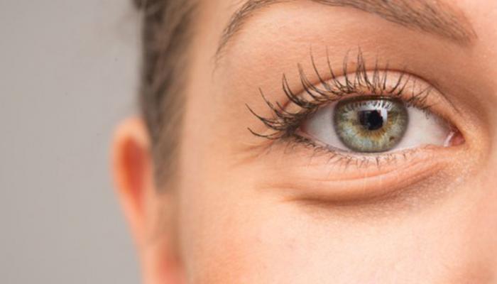 127-203548-condition-arteries-eye-warn-serious-diseases_700x400