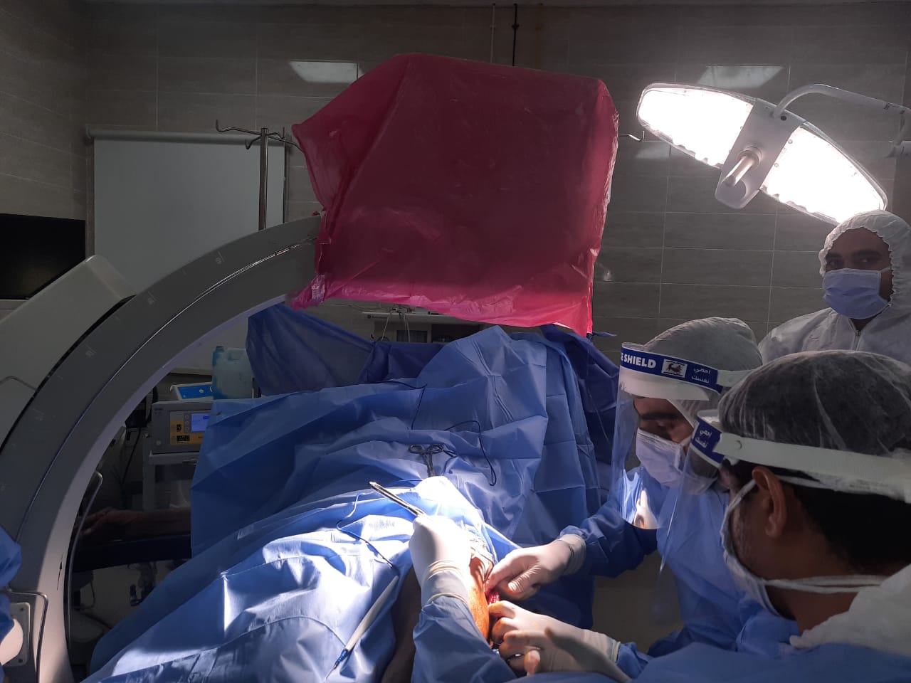 عملية جراحية وتركيب شريحة بفخذ مصاب بكورونا فى مستشفى الأقصر العام (4)