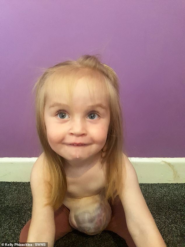 الطفلة الصغيرة