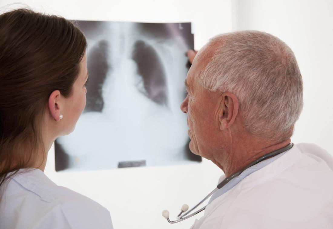 doctor-and-copd-patient-looking-at-x-ray-of-lungs