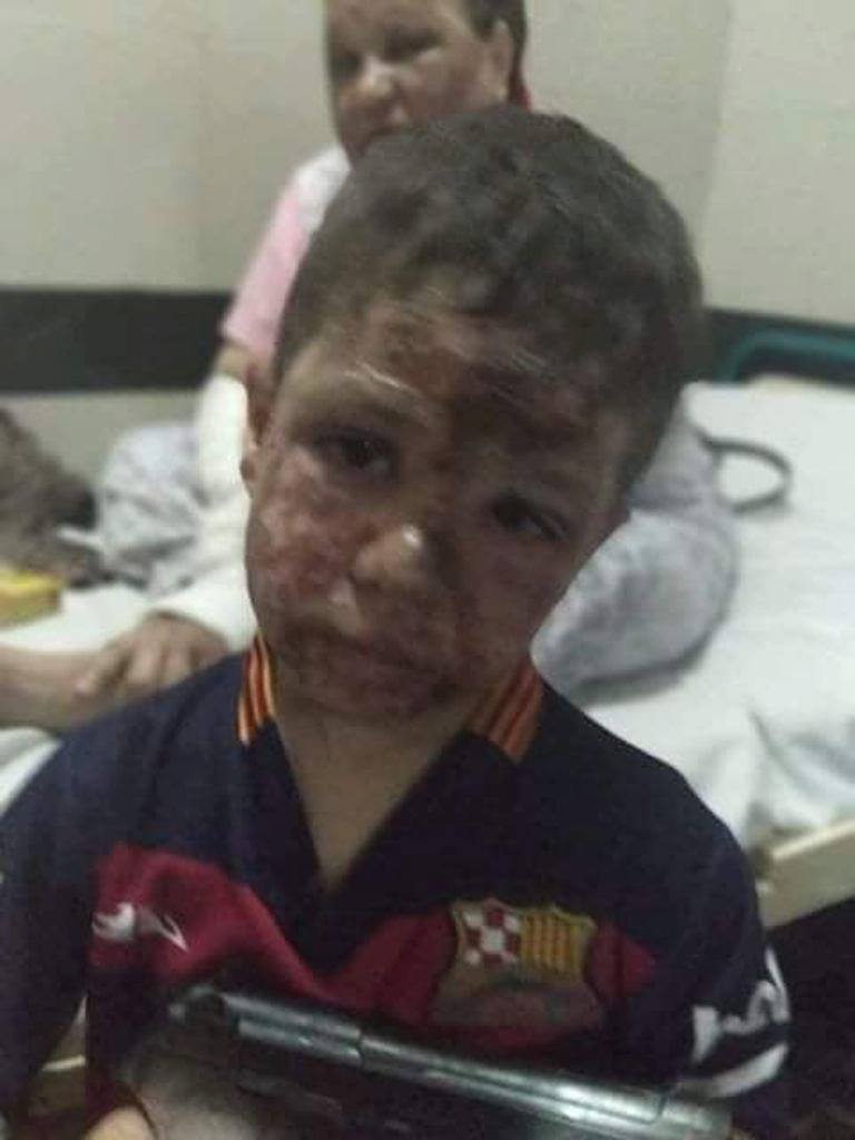 روف بطفل مصاب روف بطفل مصاب