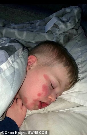 27800234-8319419-The_youngster_had_a_rash_on_his_body_a_high_temperature_red_eyes-a-5_1589463242906