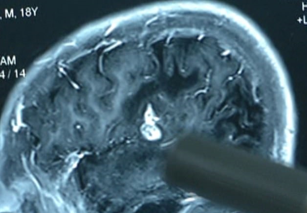 الأشعة المقطعبة لرأس المريض
