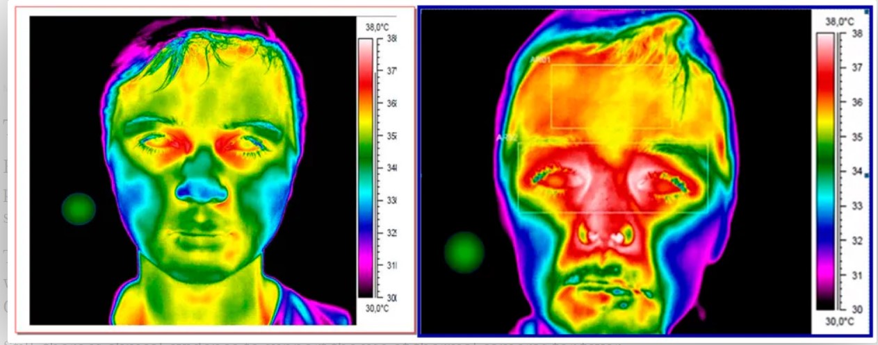 الكاميرات الحرارية 