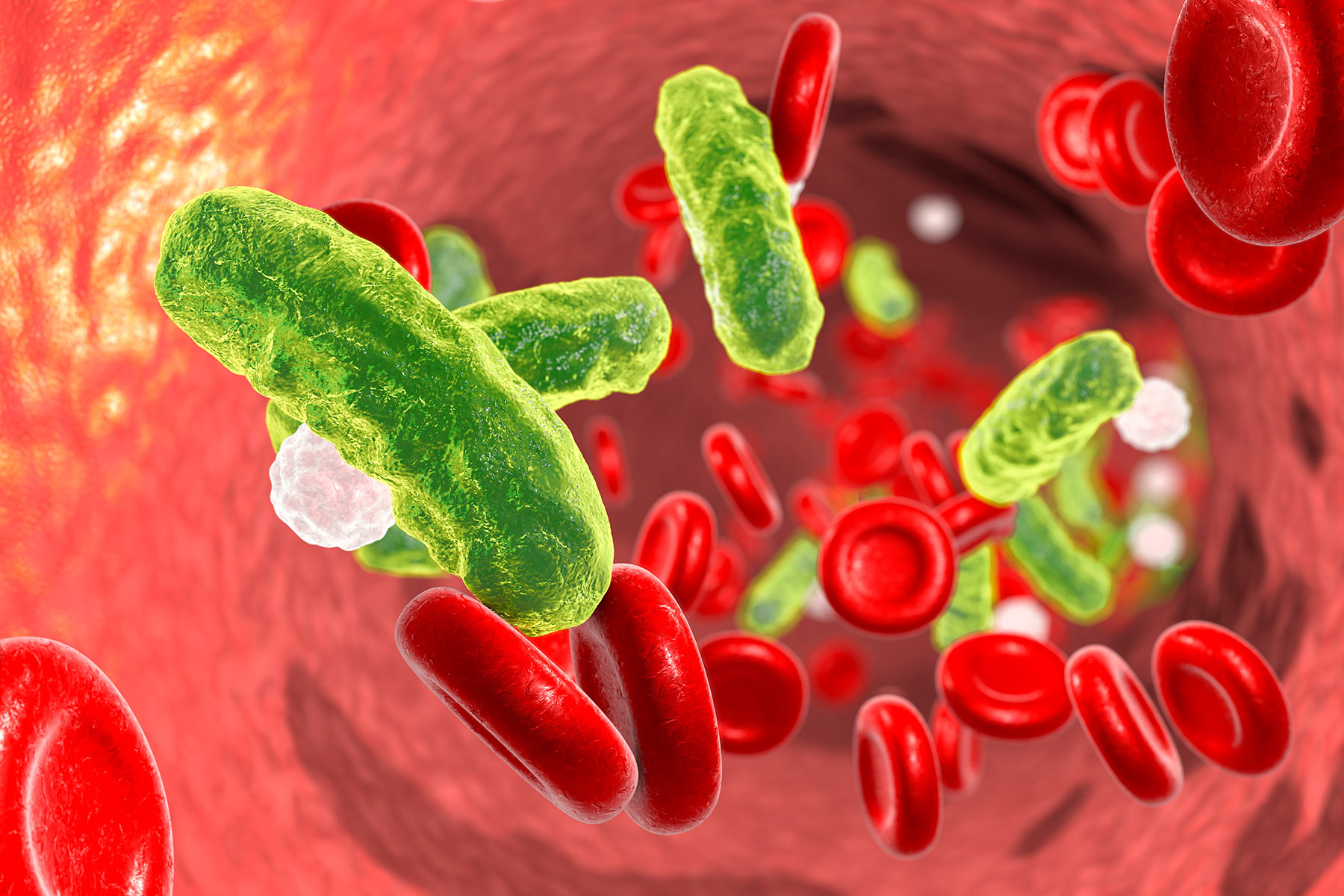 ما هو تسمم الدم وما هي طرق الوقاية من العدوى؟